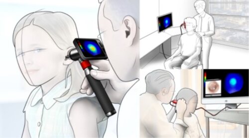 3D Otonoscope.jpg