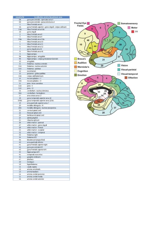 Brain localisations